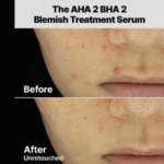 COSRX THE AHA 2 BHA 2 BLEMISH TREATMENT SERUM 50G - Image 2