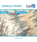 CERAVE ANTI DANDRUFF ANTIPLLICULAIF - Image 4
