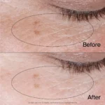 NEUTROENA COLLAGEN BANK REVIVING EYE GEL CREAM 14G - Image 5