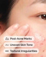 THE ORDINARY DS ALOE2% +NAG 2% SOLUTION 30ML - Image 3