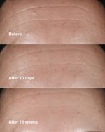 CLINIQUE WRINKLE CORRECTING SERU - Image 2