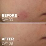 LAROCHE POSAY CICAPLAST B5 FACE SERUM 30ML - Image 5